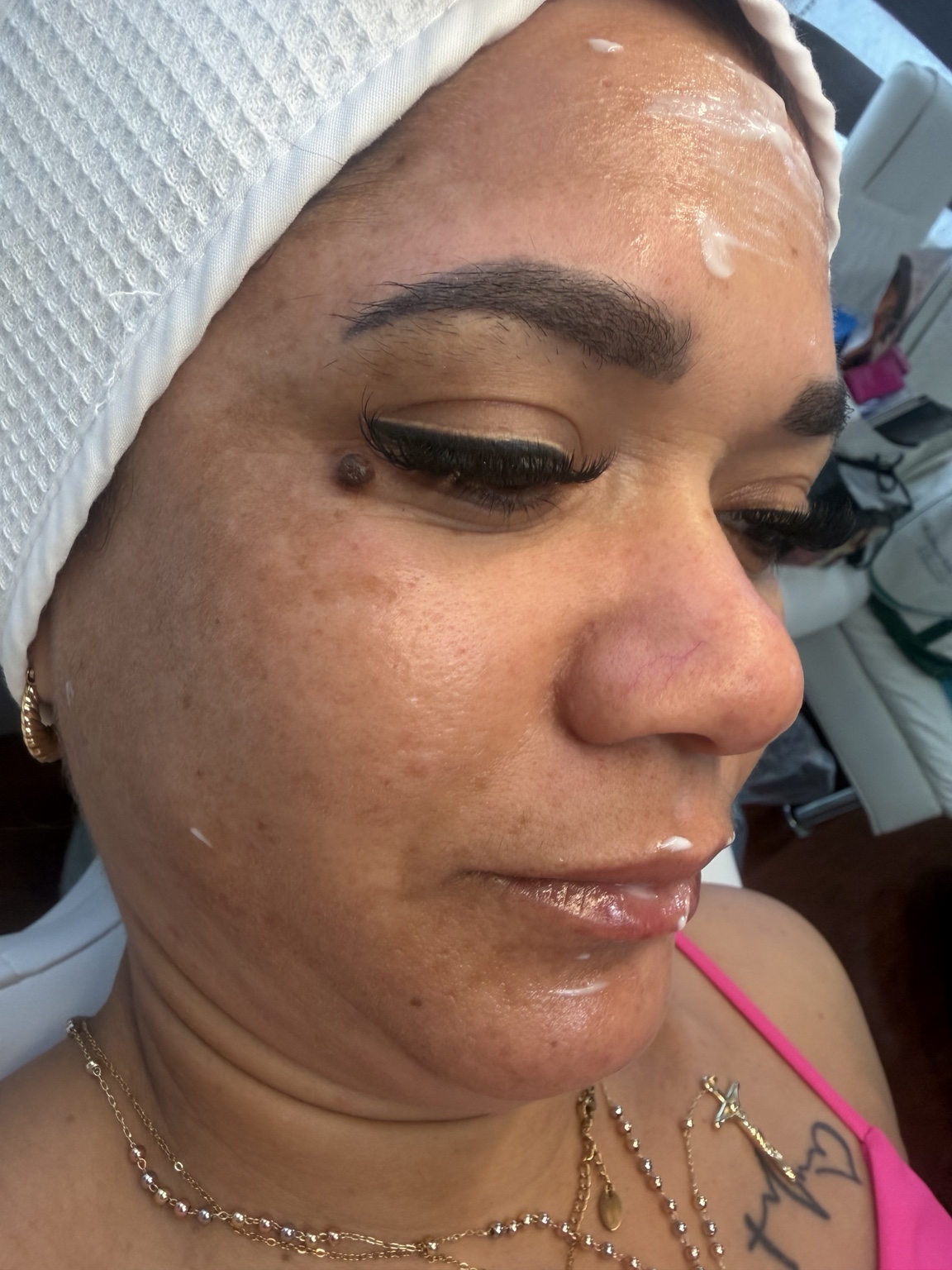 Facial treatment image showing skin care session