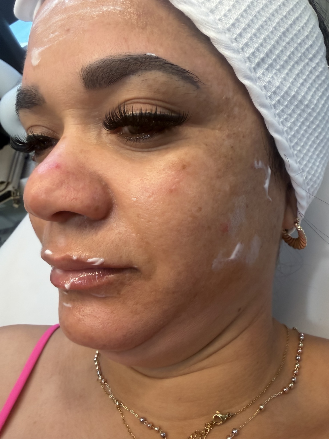 Facial treatment image showing close-up skincare session